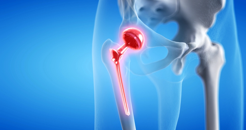 Total Hip Replacement surgery in Faridabad